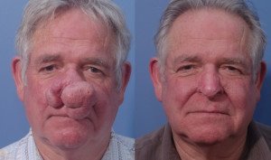 Bel-Red Center For Aesthetic Surgery - Bel-Red Center For Aesthetic Surgery