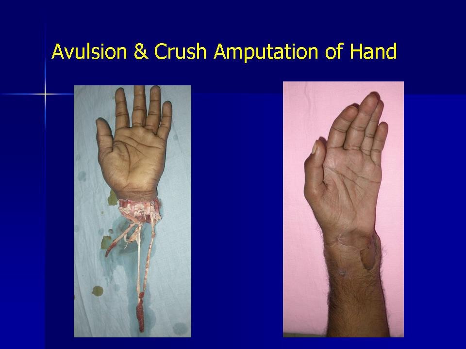 Bembde Hospital - Bembde Hospital