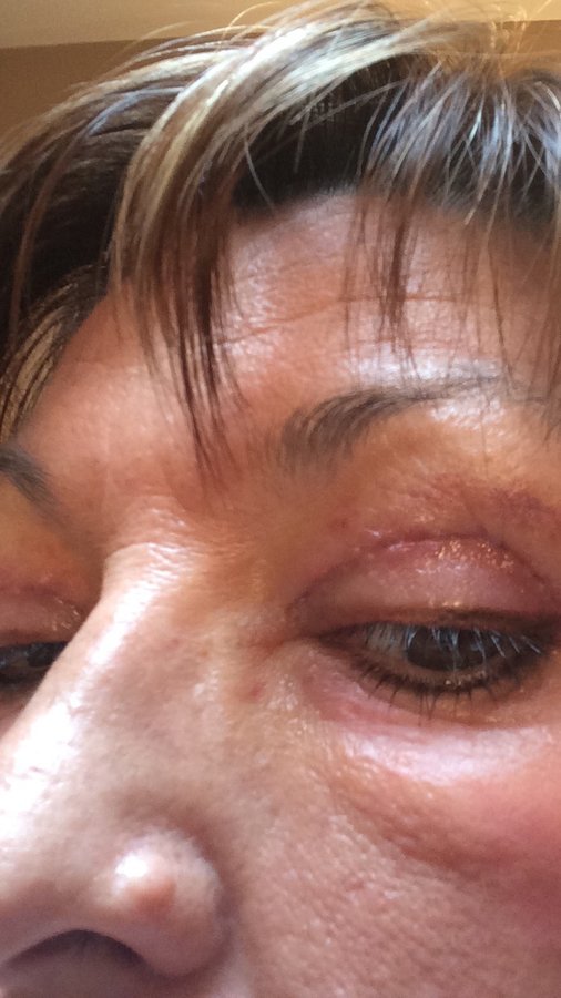 Bense SurgiSpa - Bense SurgiSpa