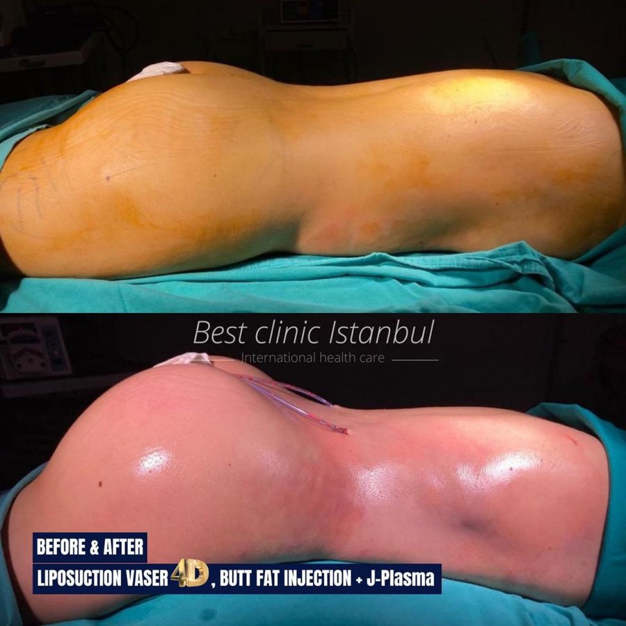 Best Clinic Istanbul - Best Clinic Istanbul