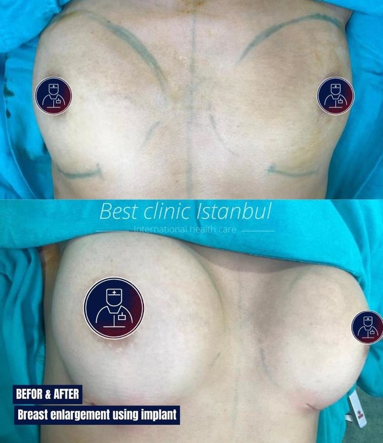 Best Clinic Istanbul - Best Clinic Istanbul