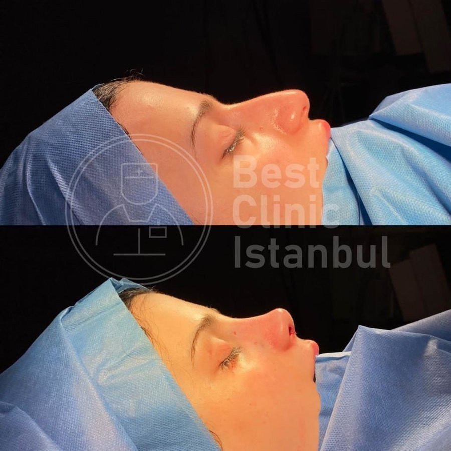 Best Clinic Istanbul - Best Clinic Istanbul