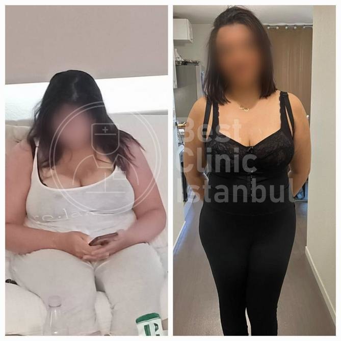 Best Clinic Istanbul - Best Clinic Istanbul