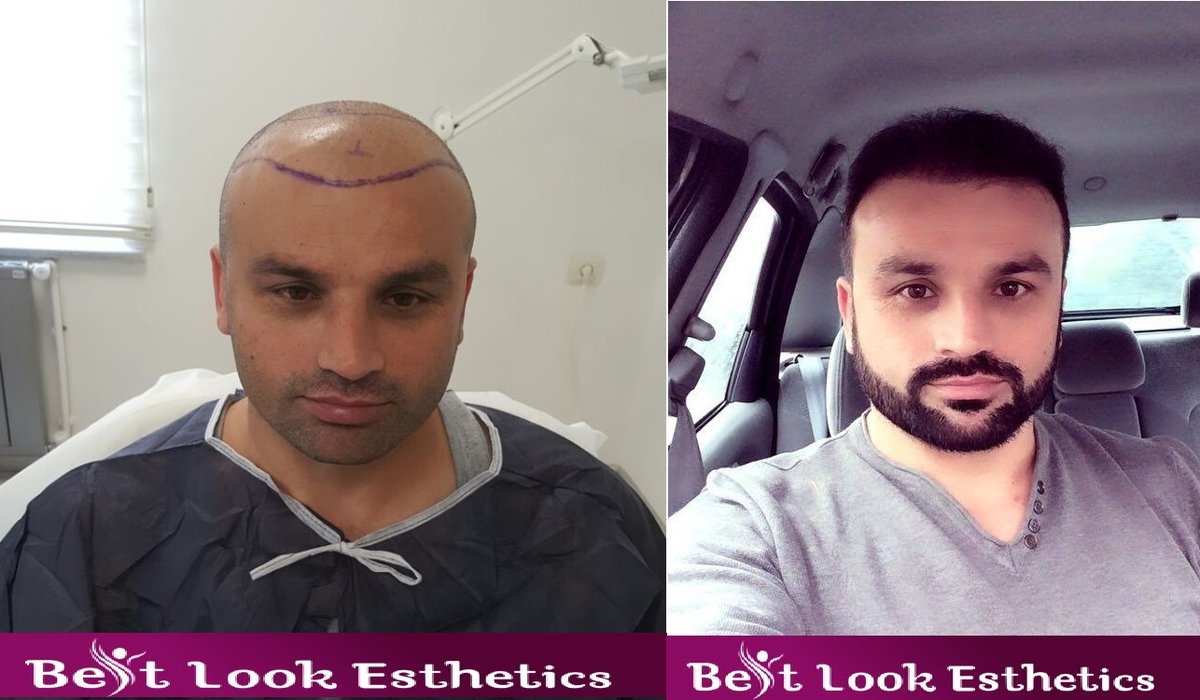 Best Look Esthetics - Best Look Esthetics