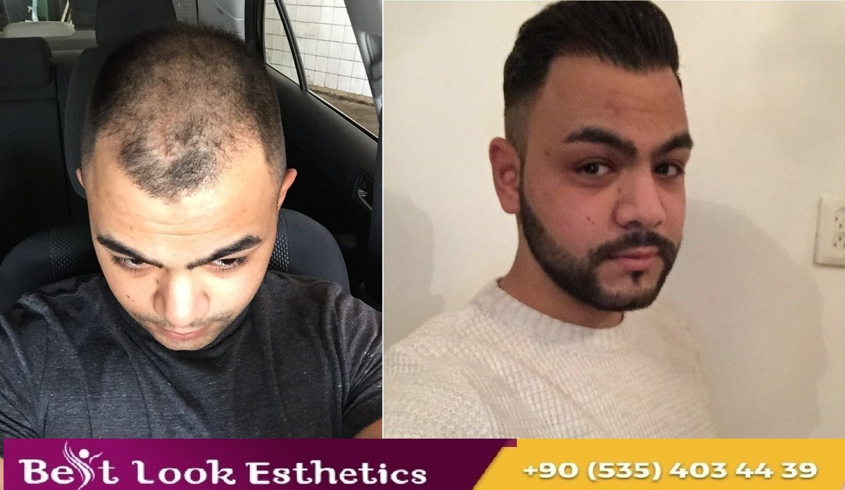 Best Look Esthetics - Best Look Esthetics