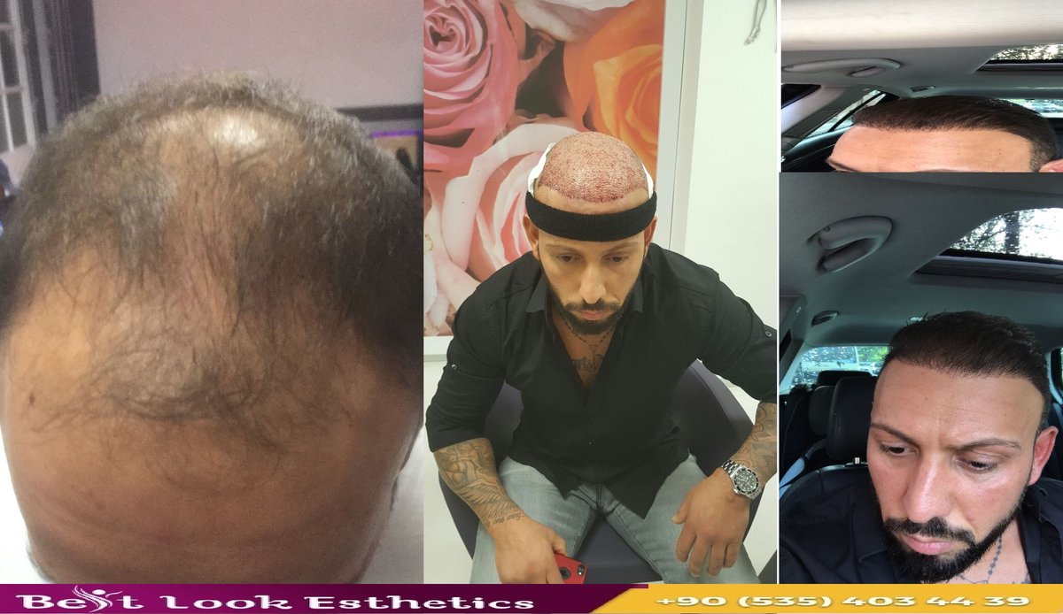 Best Look Esthetics - Best Look Esthetics