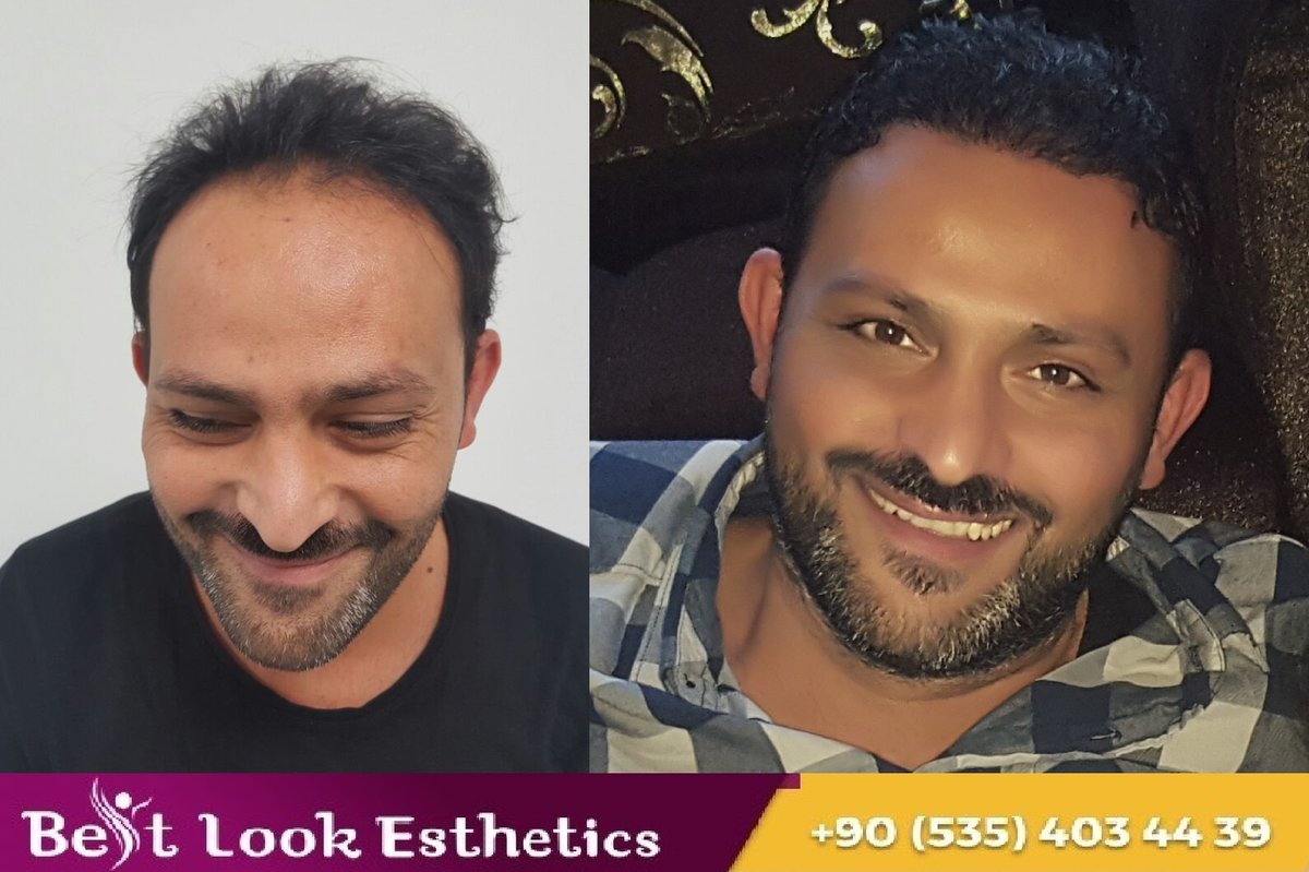 Best Look Esthetics - Best Look Esthetics