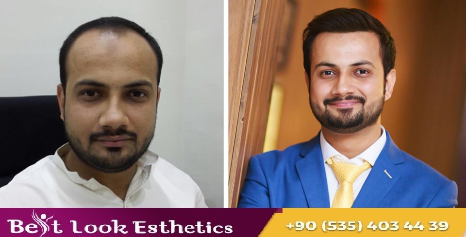 Best Look Esthetics - Best Look Esthetics