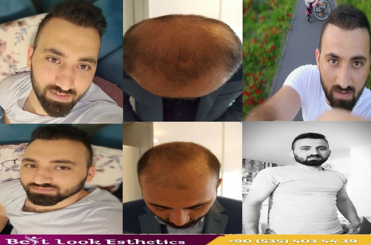 Best Look Esthetics - Best Look Esthetics