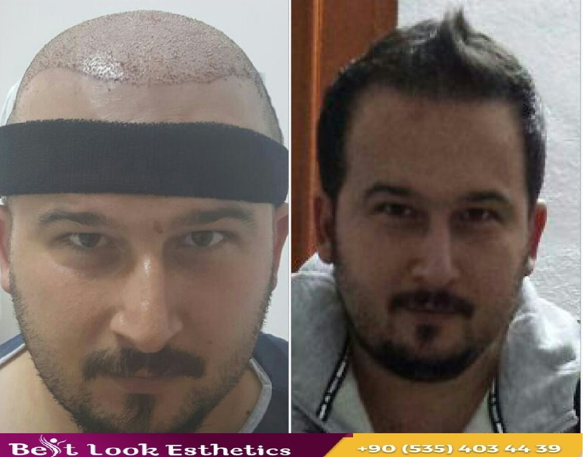 Best Look Esthetics - Best Look Esthetics