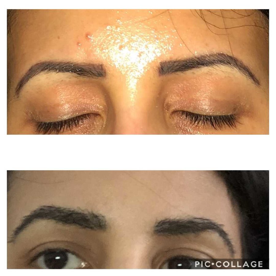 Better Hair Transplant Clinics - Surrey - Better Hair Transplant Clinics - Surrey