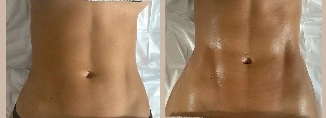 BeWell Health Assistance - BeWell Health Assistance