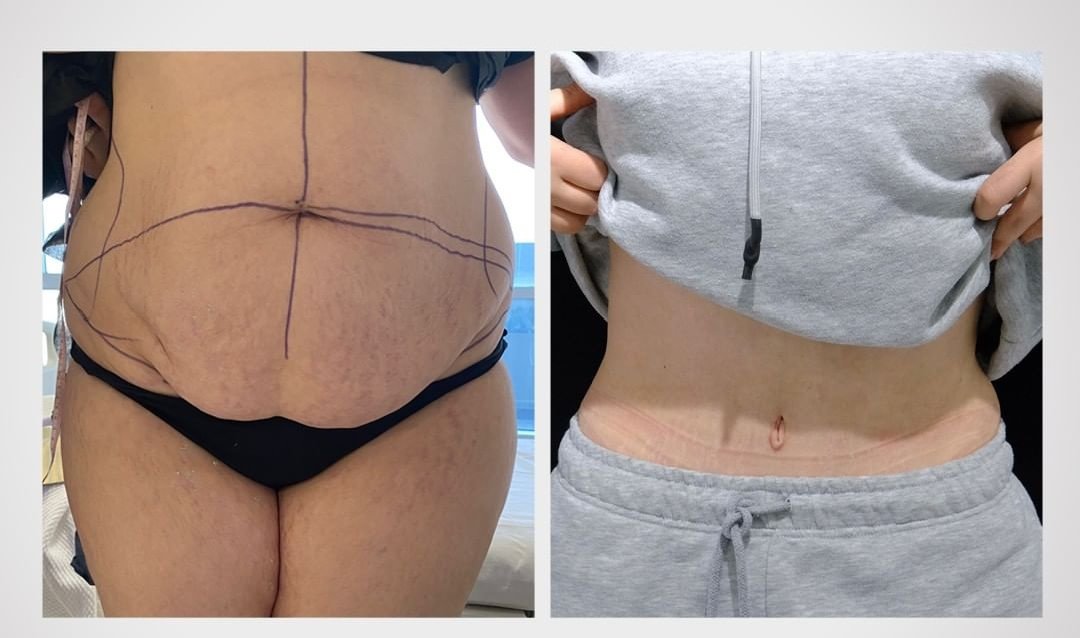 BeWell Health Assistance - BeWell Health Assistance