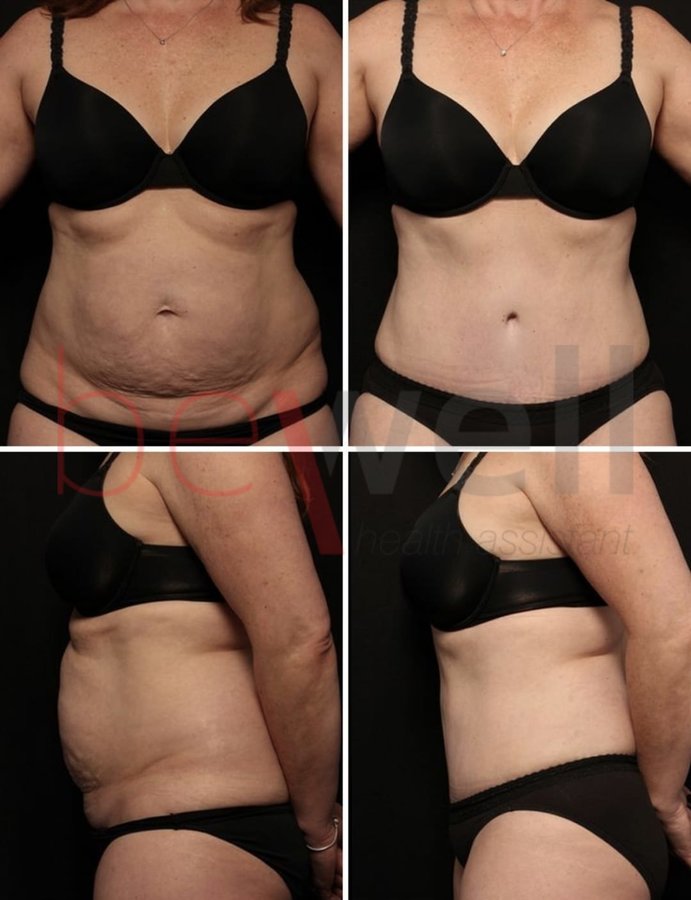 BeWell Health Assistance - BeWell Health Assistance