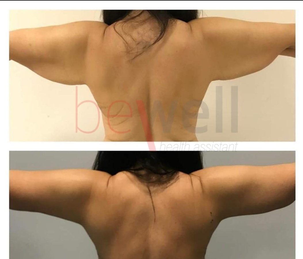 BeWell Health Assistance - BeWell Health Assistance