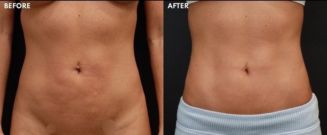 BeWell Health Assistance - BeWell Health Assistance