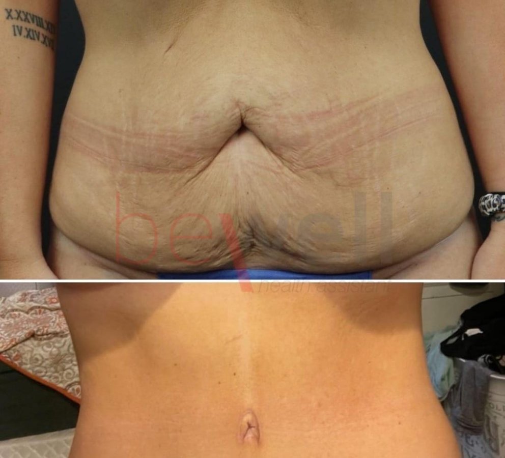 BeWell Health Assistance - BeWell Health Assistance