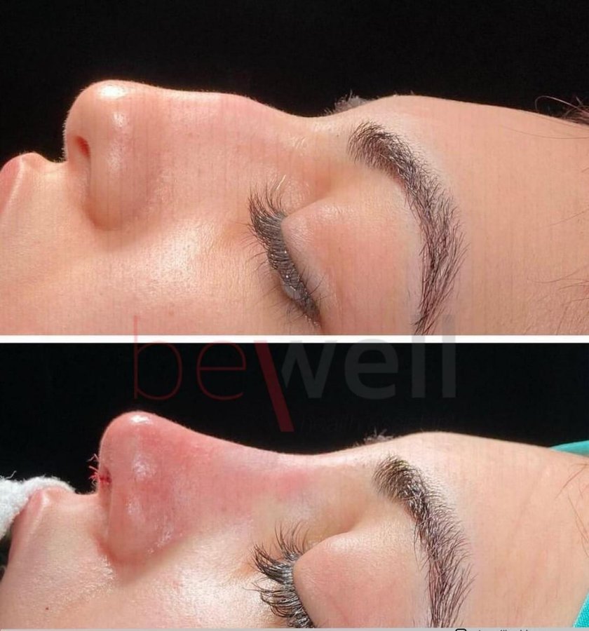 BeWell Health Assistance - BeWell Health Assistance