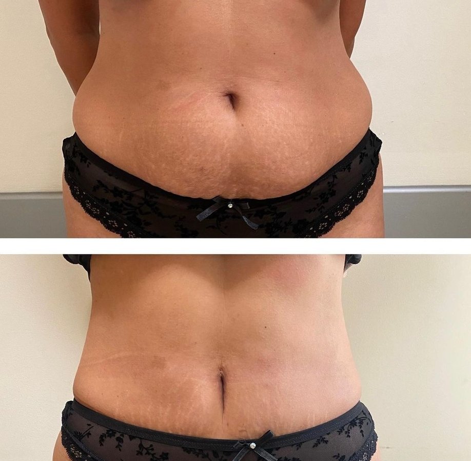 BeWell Health Assistance - BeWell Health Assistance