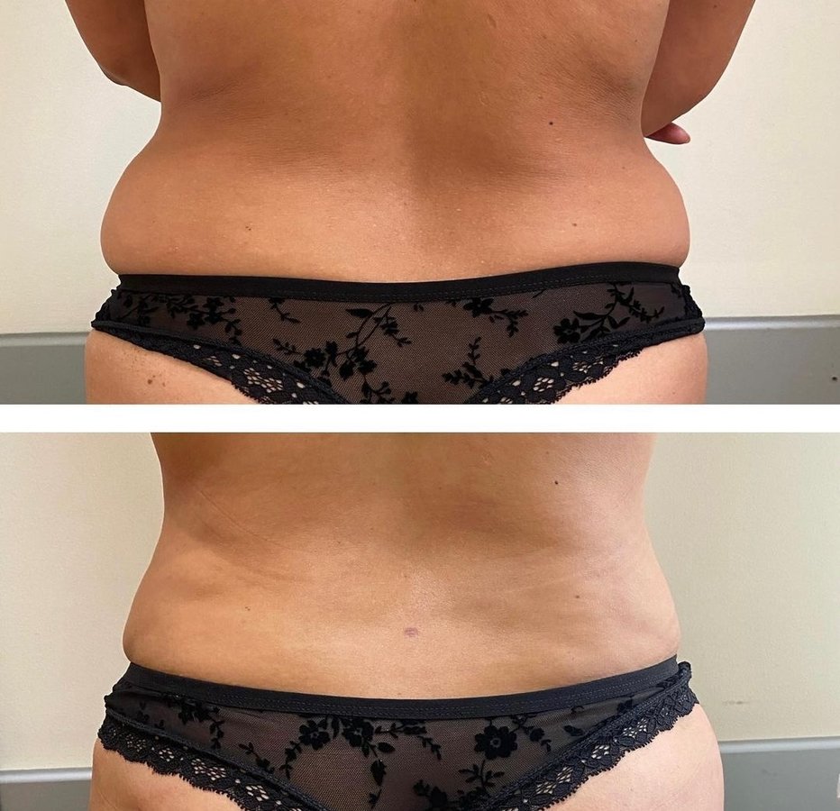 BeWell Health Assistance - BeWell Health Assistance