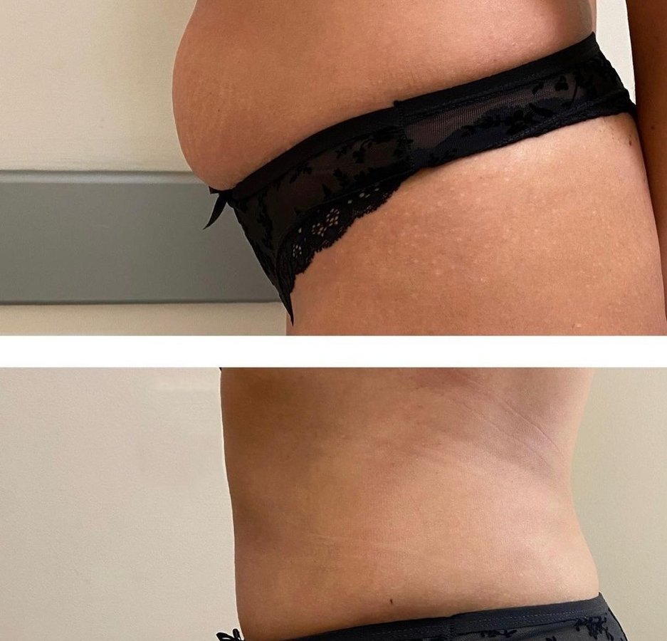 BeWell Health Assistance - BeWell Health Assistance