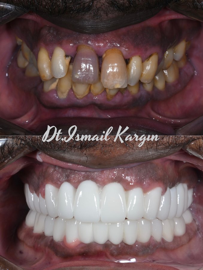 BeyazAda Dental Clinic - BeyazAda Dental Clinic