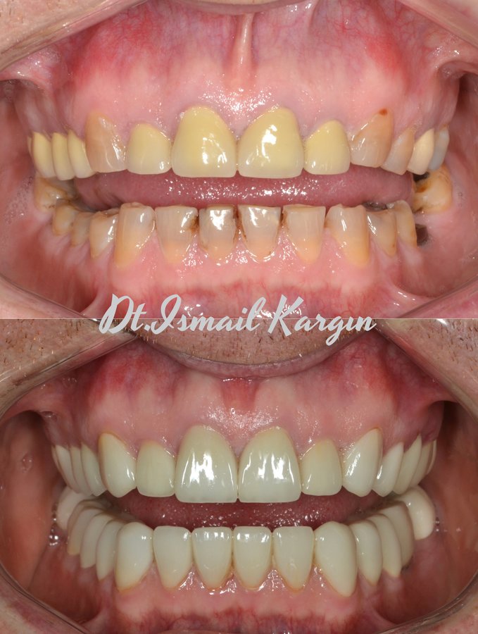 BeyazAda Dental Clinic - BeyazAda Dental Clinic