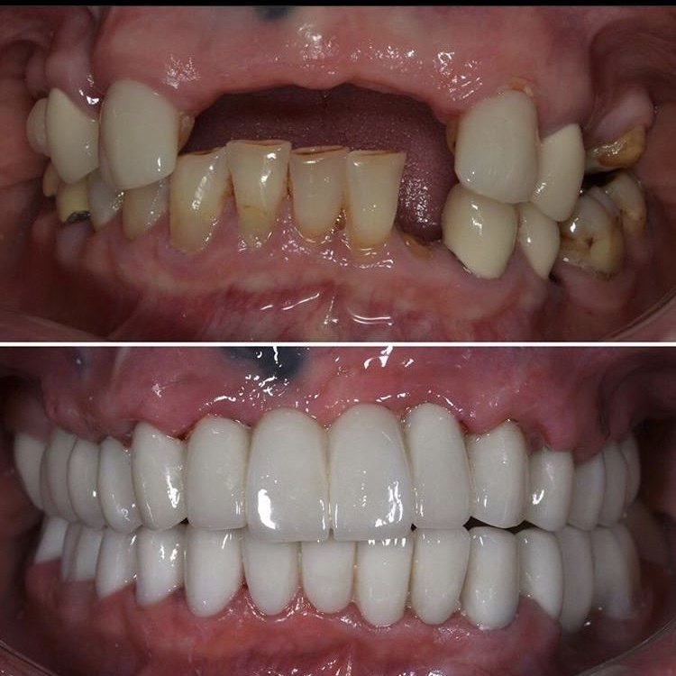 BeyazAda Dental Clinic - BeyazAda Dental Clinic