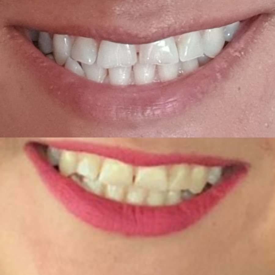 BeyazAda Dental Clinic - BeyazAda Dental Clinic