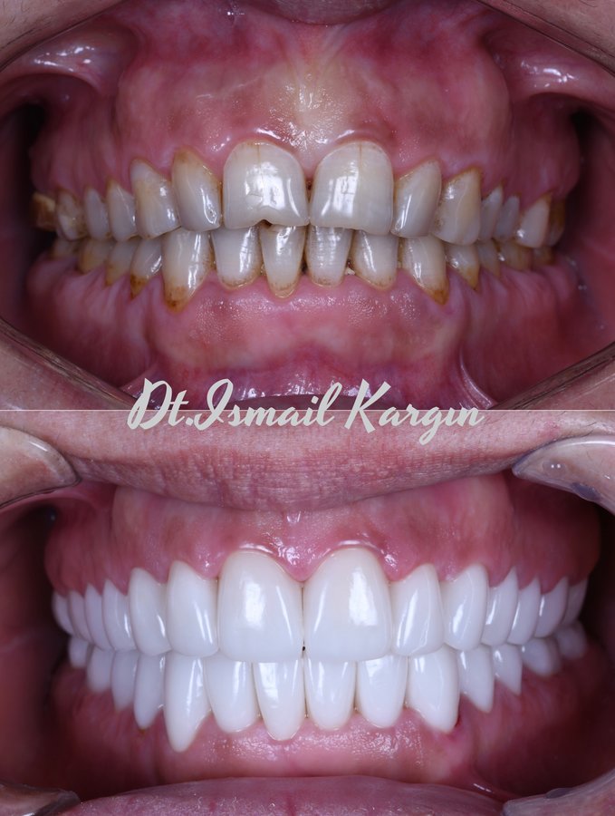 BeyazAda Dental Clinic - BeyazAda Dental Clinic