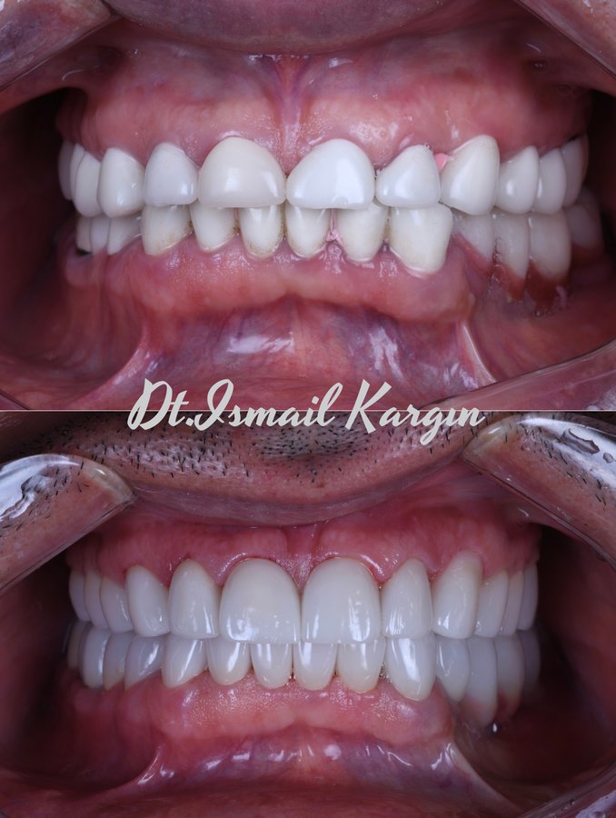 BeyazAda Dental Clinic - BeyazAda Dental Clinic
