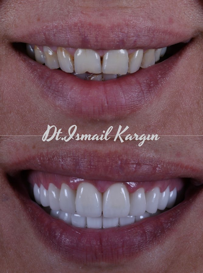 BeyazAda Dental Clinic - BeyazAda Dental Clinic