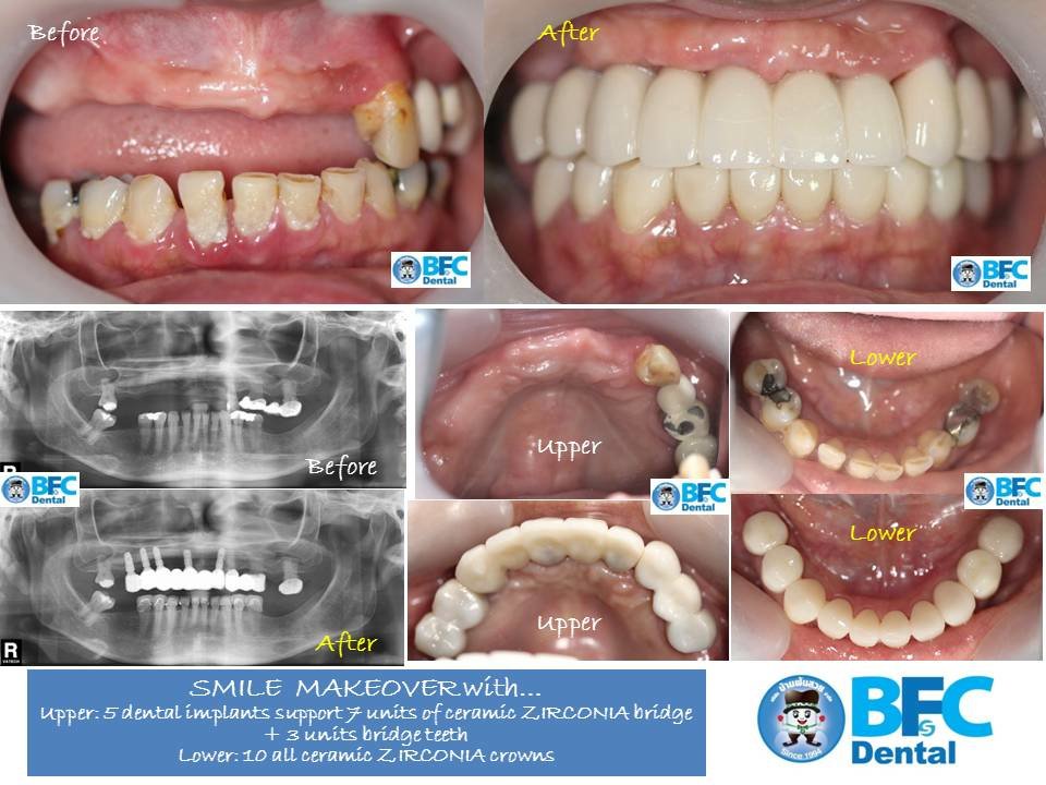 BFC Dental - BFC Dental