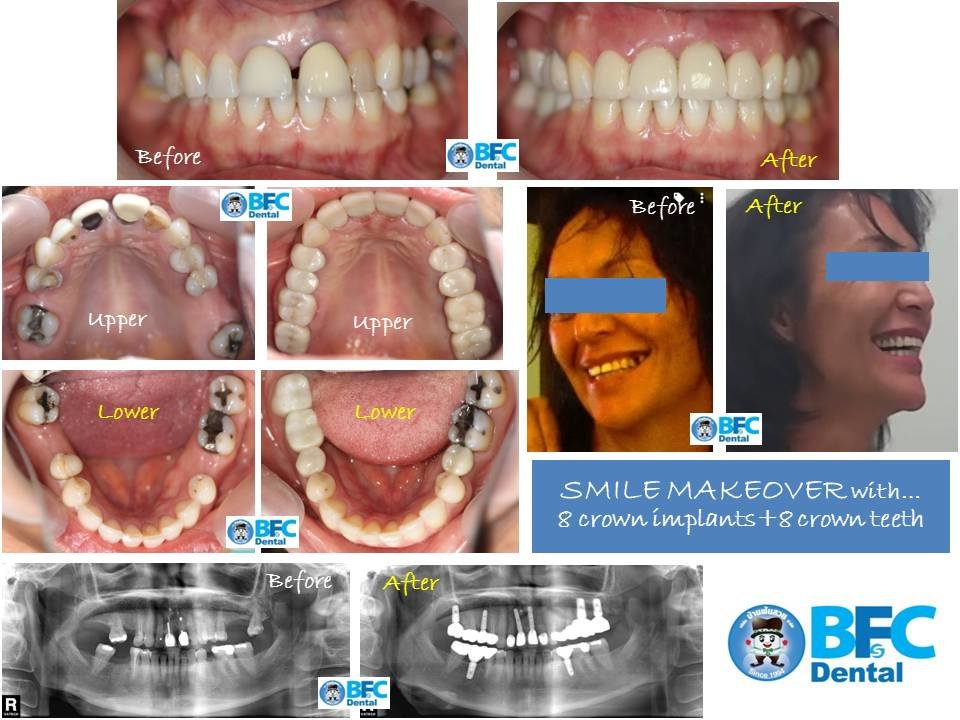BFC Dental - BFC Dental