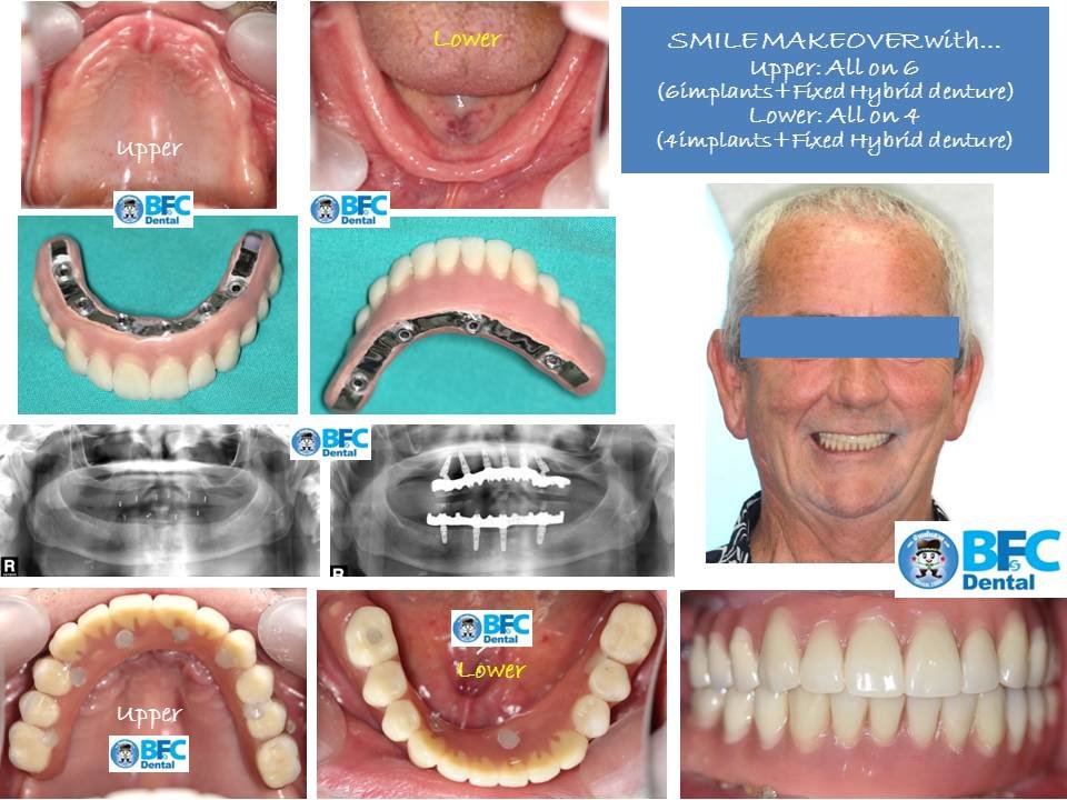 BFC Dental - BFC Dental
