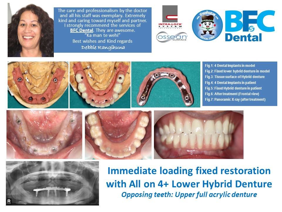 BFC Dental - BFC Dental
