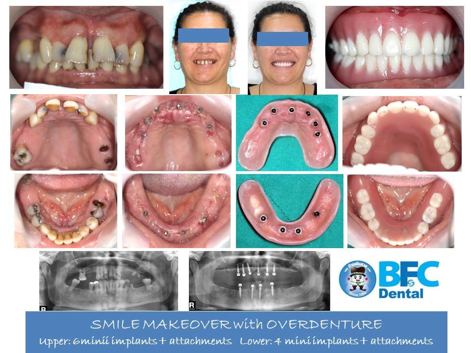 BFC Dental - BFC Dental