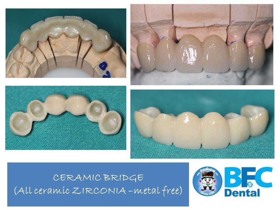 BFC Dental - BFC Dental