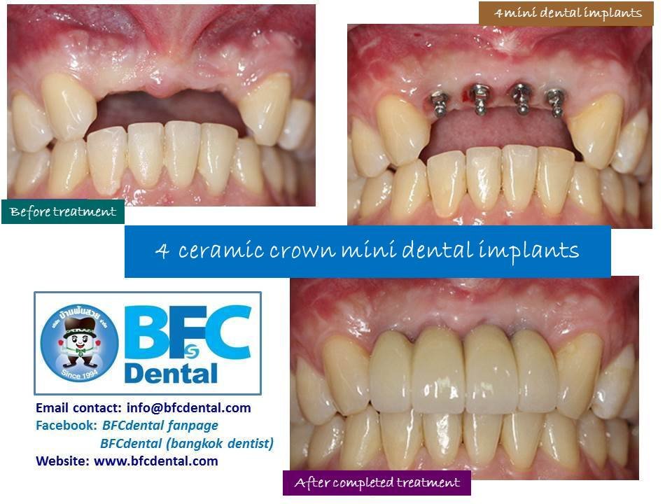 BFC Dental - BFC Dental