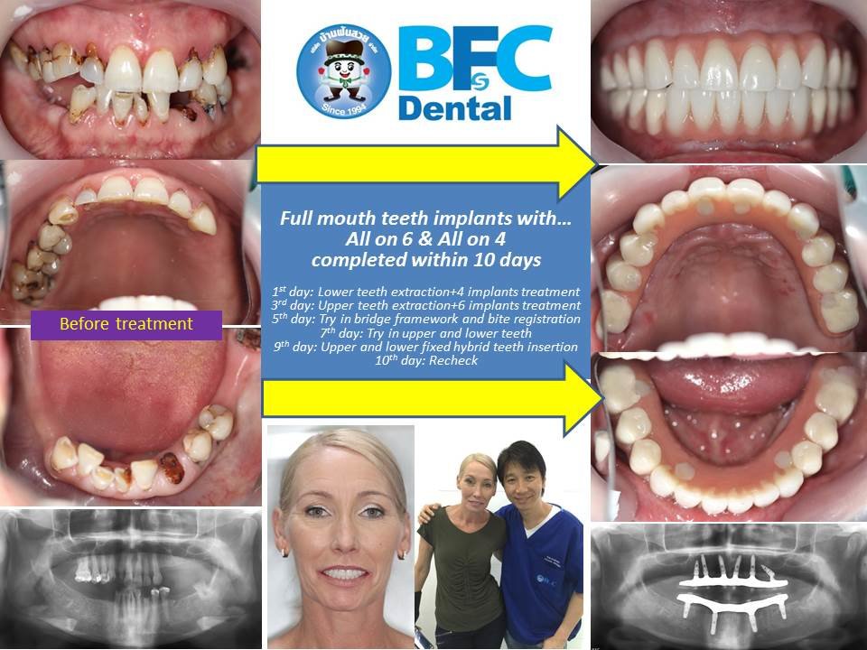 BFC Dental - BFC Dental