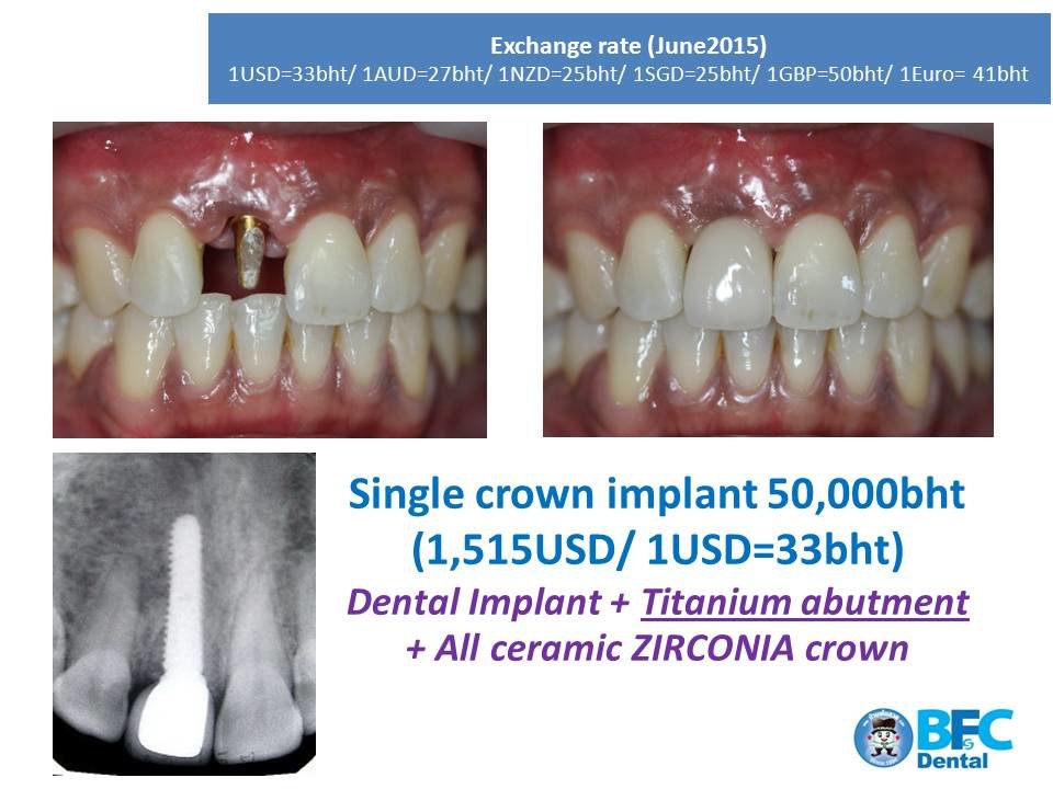 BFC Dental - BFC Dental