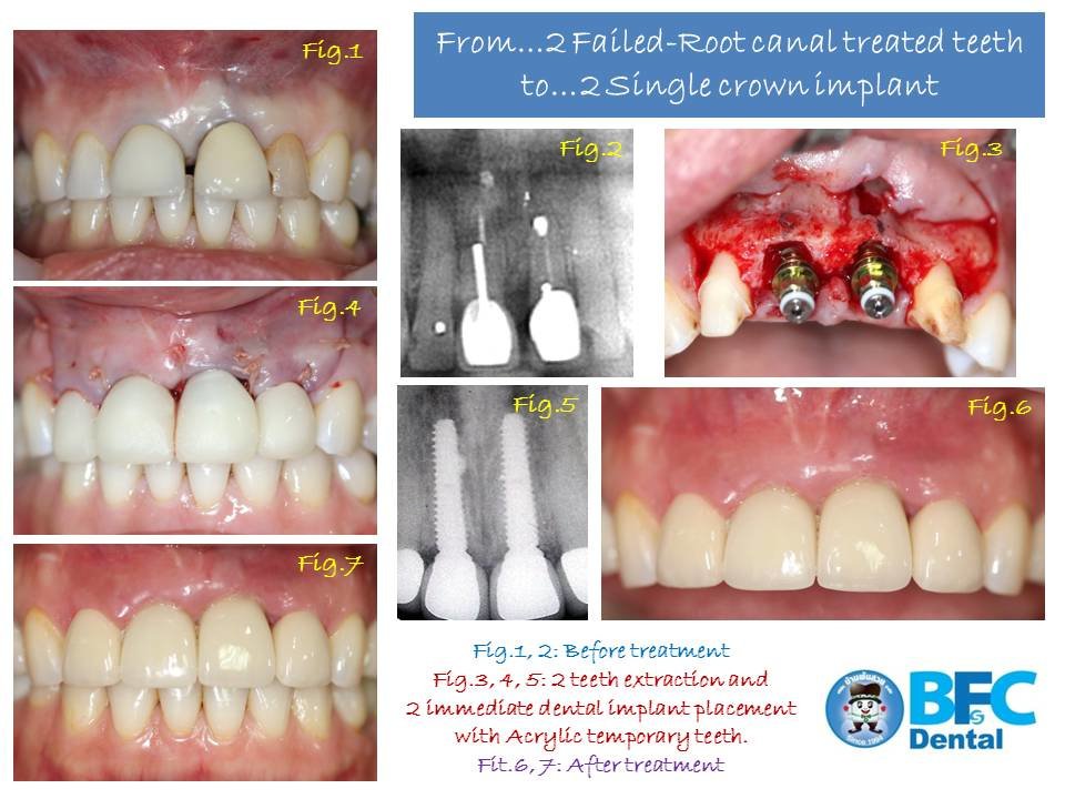 BFC Dental - BFC Dental