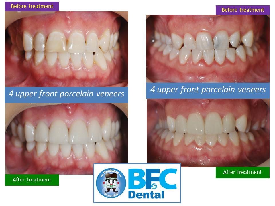 BFC Dental - BFC Dental