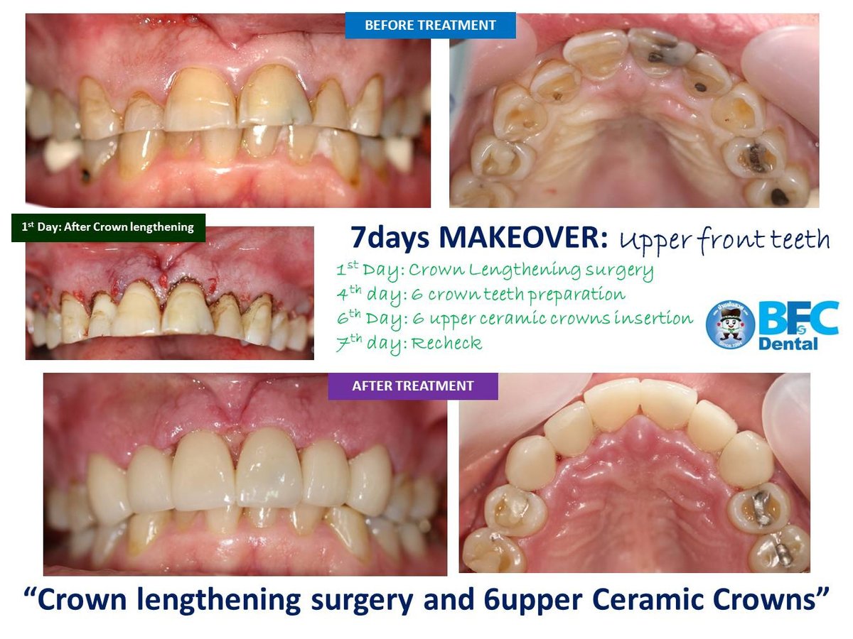 BFC Dental - BFC Dental