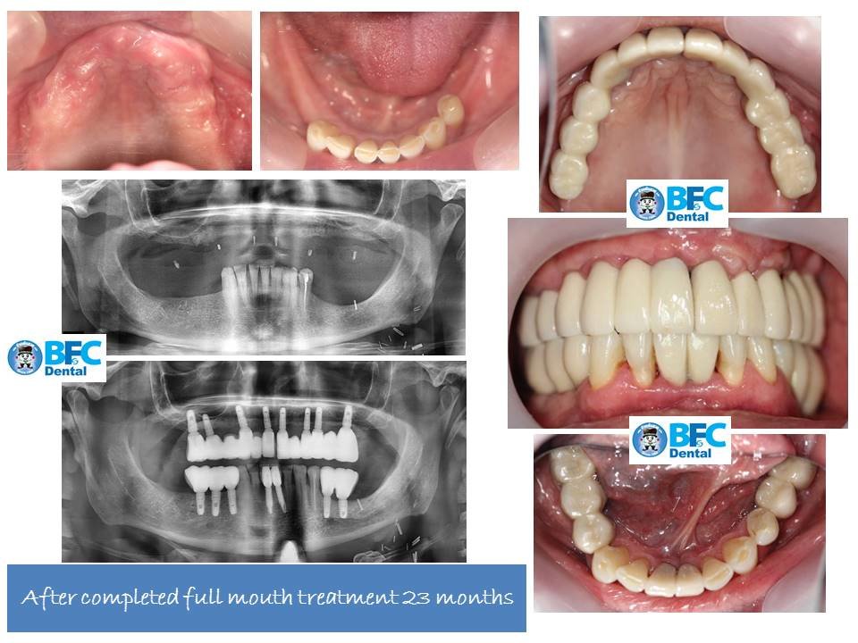 BFC Dental - BFC Dental