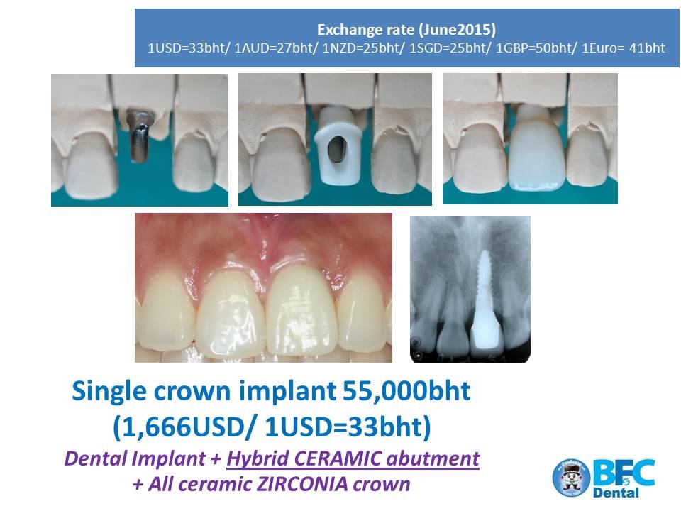 BFC Dental - BFC Dental