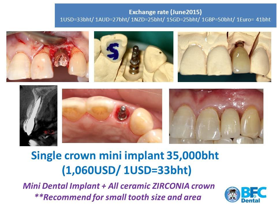 BFC Dental - BFC Dental