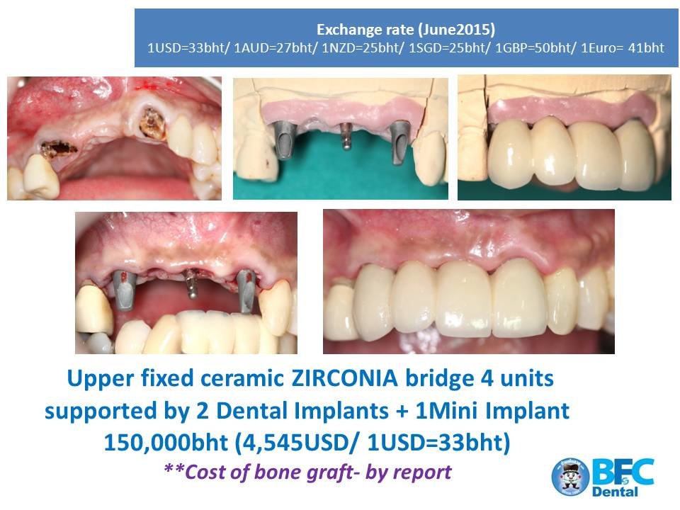 BFC Dental - BFC Dental