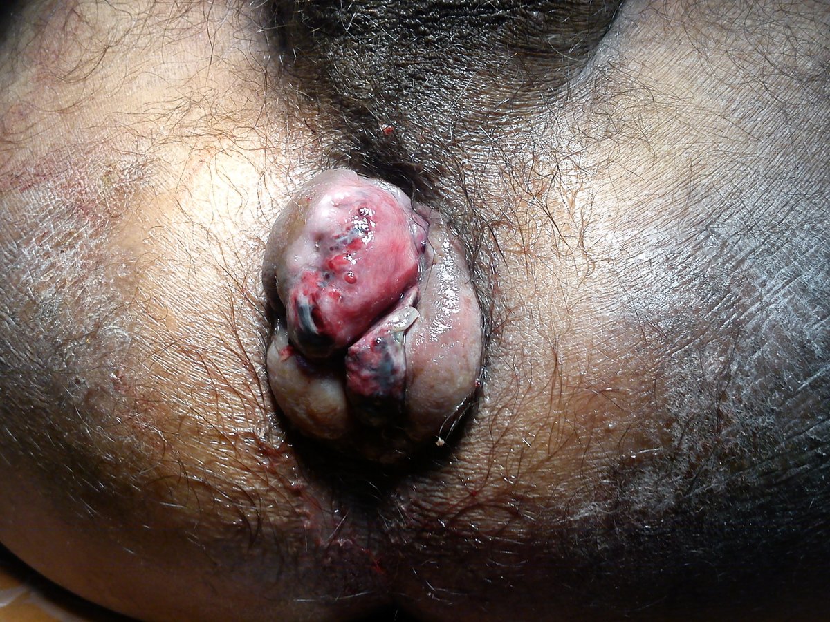 Bhopal Ayurvedic Surgical Center And Wound Clinic - Bhopal Ayurvedic Surgical Center And Wound Clinic