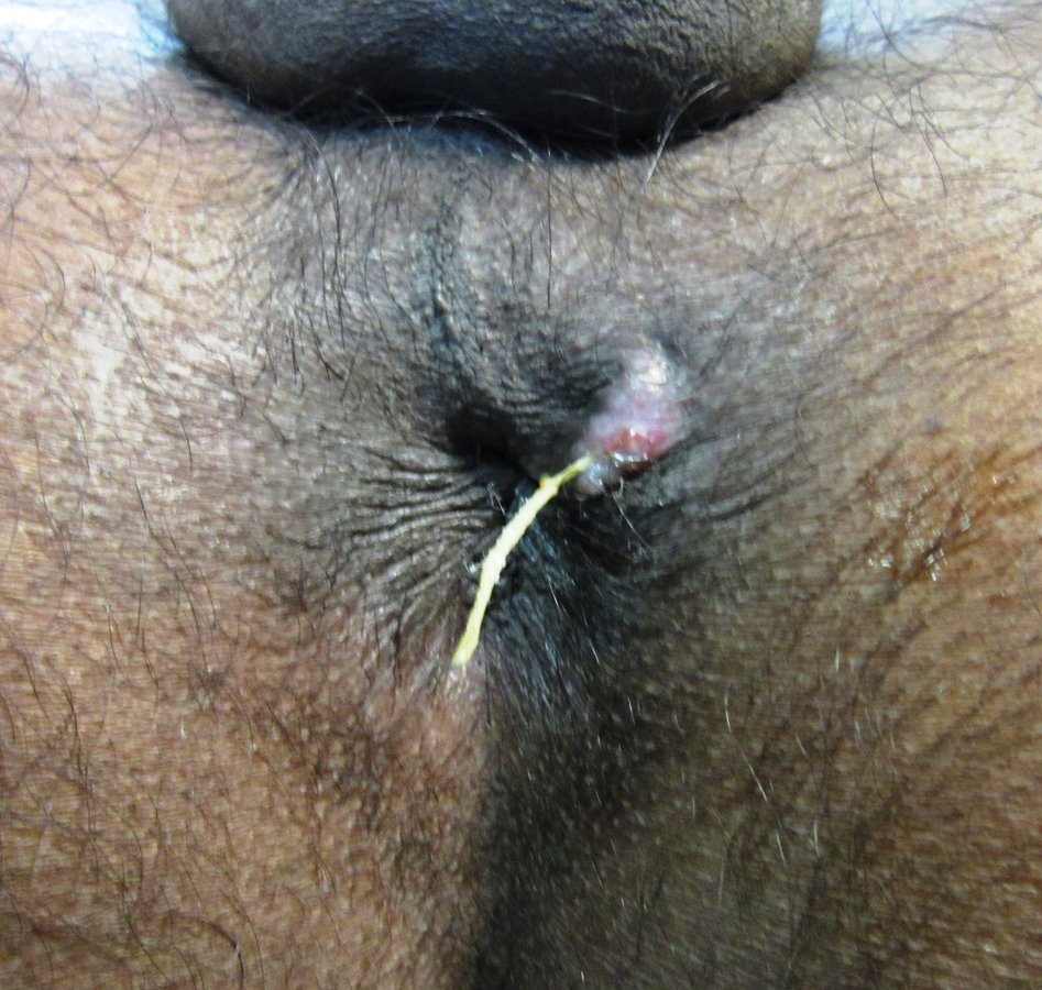 Bhopal Ayurvedic Surgical Center And Wound Clinic - Bhopal Ayurvedic Surgical Center And Wound Clinic